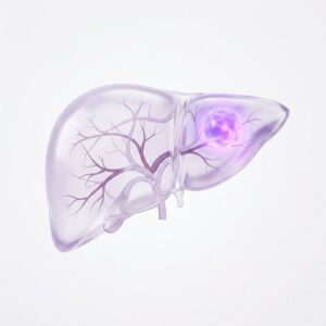 Illustration of the liver with a tumor